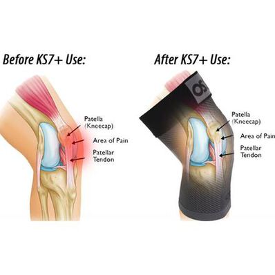 OS1st KS7+ Unisex Adjustable Performance Single Knee Sleeve, , large